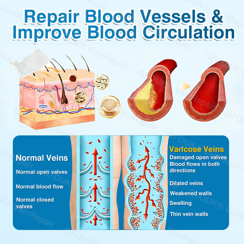 🇺🇸🏆✅️🏃GFOUK® VeinRepair Microneedle Patch Roll⚡Instant Relief, Long-Term Results
